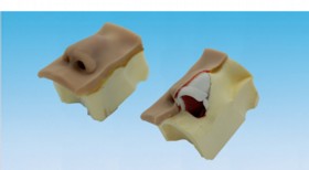 Non-Surgical Rhinoplasty